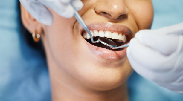 Best Broken or Cracked Tooth Emergency Dentist in Pepeekeo, HI